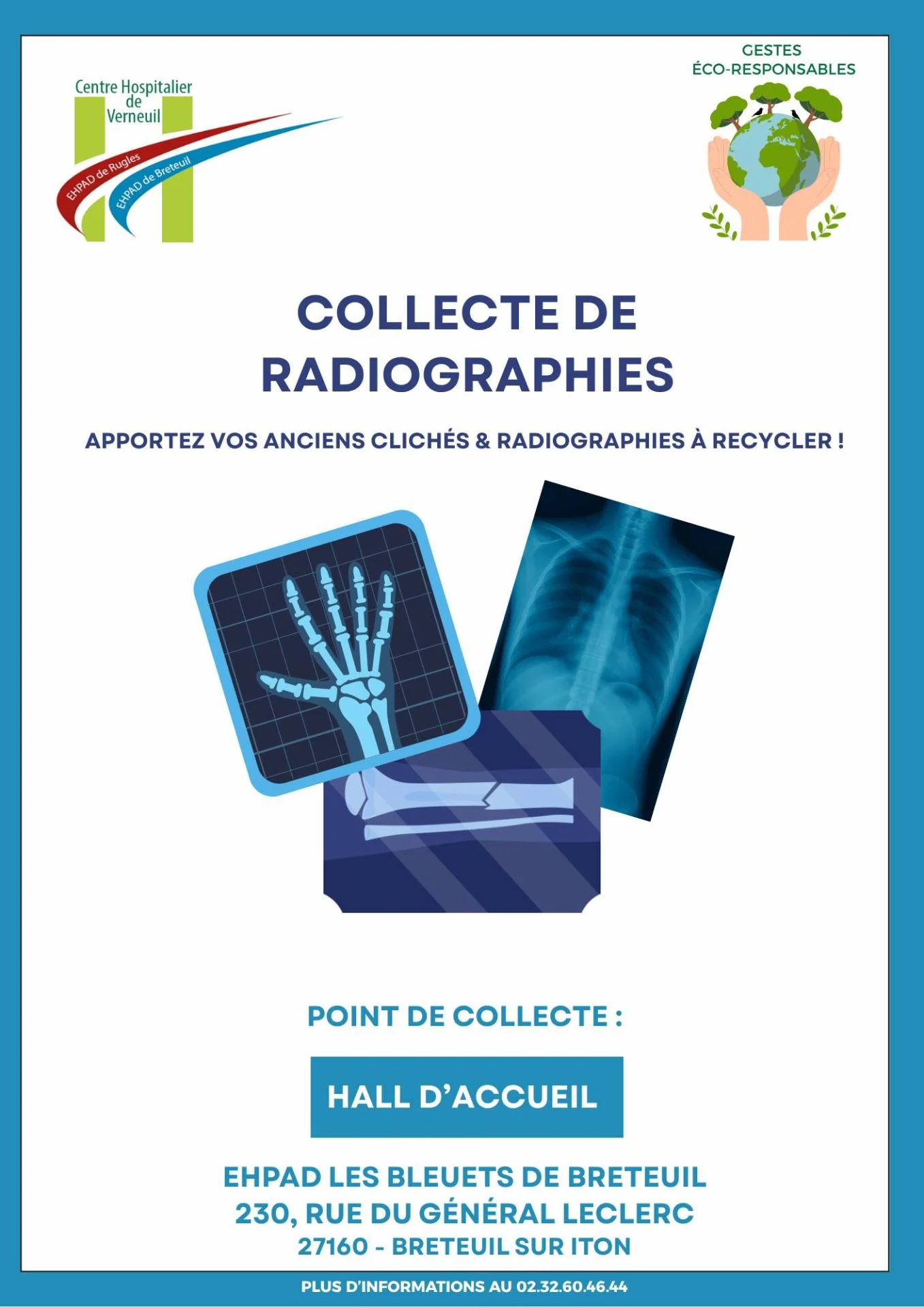 Radiographies breteuil