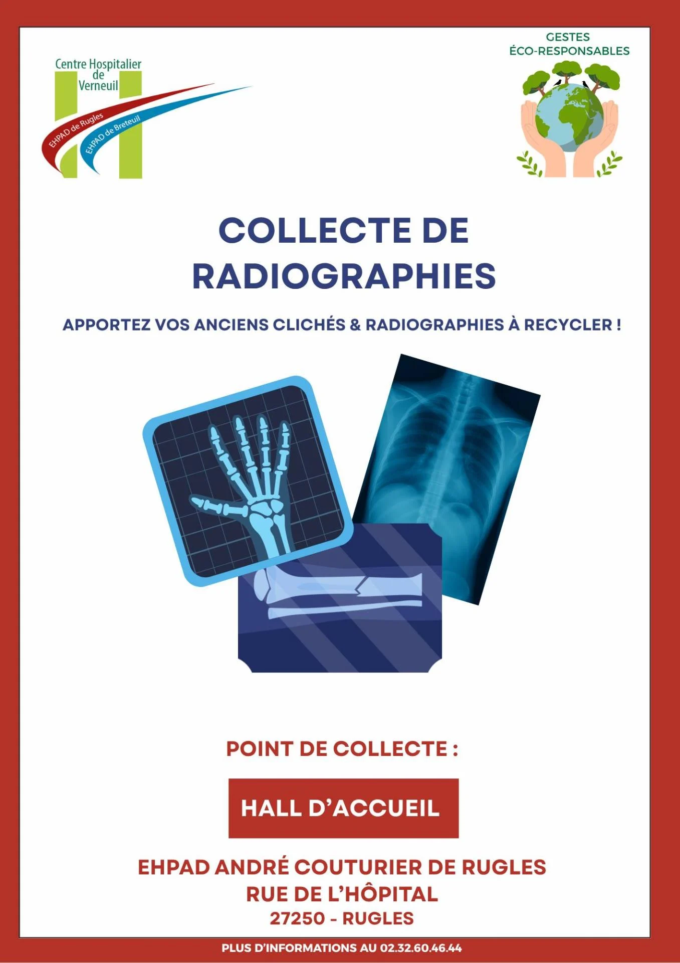 Radiographies rugles